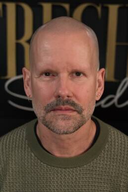 Fresher Studios healed scalp micro pigmentation (SMP) result—front portrait with head tilted down, showing a natural hairline and realistic density salt and pepper