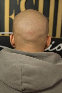 Fresher Studios healed scalp micro pigmentation (SMP) result—back view showing smooth, even coverage and natural density through the crown.